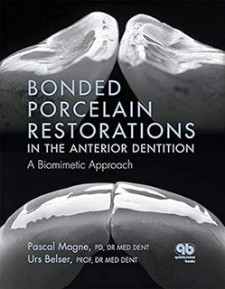 ~Pdf~ (Download) Bonded Porcelain Restorations in the Anterior Dentition: A Biomimetic Approach BY