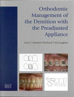 DOWNLOAD FREE Orthodontic Management of the Dentition with the Preadjusted Appliance Written by  Jo