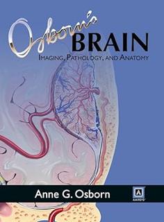 DOWNLOAD PDF Osborn's Brain *  Anne G. Osborn MD FACR (Author)   Anne G. Osborn MD FACR (Author)  [
