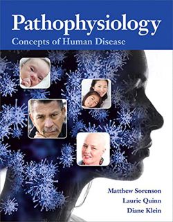 [Access] [EBOOK EPUB KINDLE PDF] Pathophysiology: Concepts of Human Disease by  Matthew Sorenson,Lau