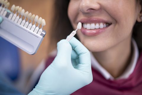 Dental Fillings: A Comprehensive Guide to Keeping Your Smile Healthy