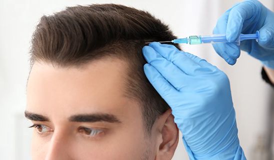 Benefits of PRP Hair Treatment in Dubai in 2024