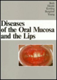 Access [EPUB KINDLE PDF EBOOK] Diseases of the Oral Mucosa and the Lips by  Konrad Bork MD,Nikolaus