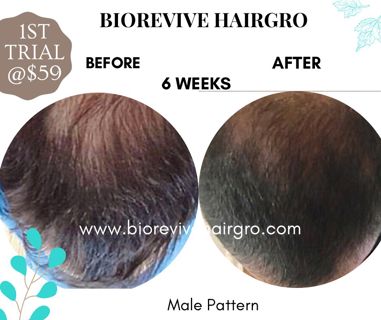 Top 10 Reasons to Choose BioRevive HairGro