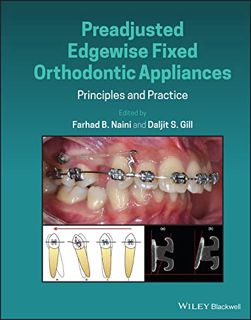 [Read] EBOOK EPUB KINDLE PDF Preadjusted Edgewise Fixed Orthodontic Appliances: Principles and Pract