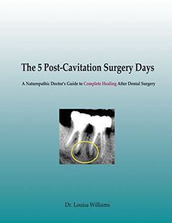 Read EPUB KINDLE PDF EBOOK The 5 Post-Cavitation Surgery Days: A Naturopathic Doctor's Guid to Compl