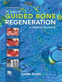 [GET] EPUB KINDLE PDF EBOOK 20 Years of Guided Bone Regeneration in Implant Dentistry: Second Editio