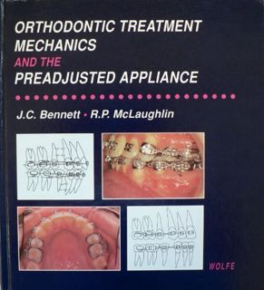 View EBOOK EPUB KINDLE PDF Orthodontic Treatment Mechanics and the Preadjusted Appliance by  John C.