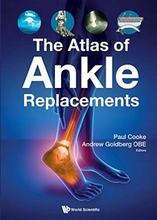 [GET] KINDLE PDF EBOOK EPUB The Atlas of Ankle Replacements by  Andrew J Goldberg,Andrew J Goldberg,