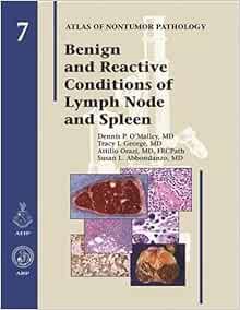 [ACCESS] EPUB KINDLE PDF EBOOK Benign and Reactive Conditions of Lymph Node and Spleen (Atlas of Non