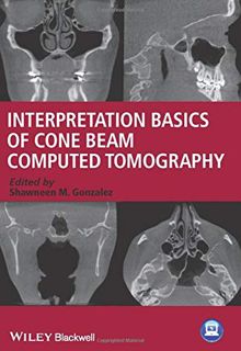 Access KINDLE PDF EBOOK EPUB Interpretation Basics of Cone Beam Computed Tomography by  Shawneen M.