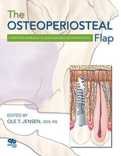 VIEW EPUB KINDLE PDF EBOOK The Osteoperiosteal Flap: A Simplified Approach to Alveolar Bone Reconstr