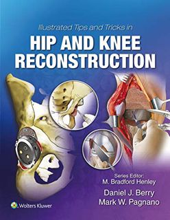 VIEW KINDLE PDF EBOOK EPUB Illustrated Tips and Tricks in Hip and Knee Reconstructive and Replacemen