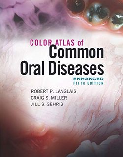 ACCESS [EBOOK EPUB KINDLE PDF] Color Atlas of Common Oral Diseases, Enhanced Edition by  Robert P. L