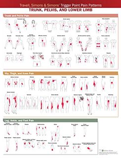 Read KINDLE PDF EBOOK EPUB Travell, Simons & Simons’ Trigger Point Pain Patterns Wall Chart: Trunk,