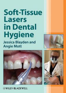 [Get] [KINDLE PDF EBOOK EPUB] Soft-Tissue Lasers in Dental Hygiene by  Jessica Blayden &  Angie Mott