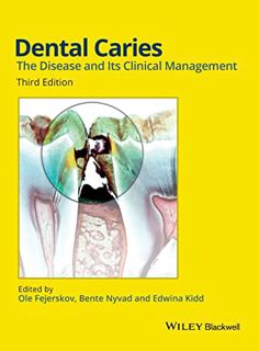 Read [PDF EBOOK EPUB KINDLE] Dental Caries: The Disease and its Clinical Management by  Bente Nyvad,