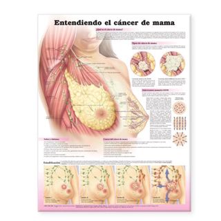 Get [EPUB KINDLE PDF EBOOK] Understanding Breast Cancer Anatomical Chart in Spanish/Entendiendo El C