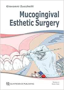 VIEW KINDLE PDF EBOOK EPUB Mucogingival Esthetic Surgery by Giovanni Zucchelli 📝