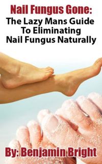 GET [KINDLE PDF EBOOK EPUB] Nail Fungus Treatment:The Lazy Man Guide To Curing Nail Fungus Infection