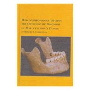 Get [EBOOK EPUB KINDLE PDF] How Anthropology Informs the Orthodontic Diagnosis of Malocclusion's Cau