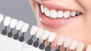 Best Drugstore Teeth Whitening Products: Effective Solutions at Affordable Prices
