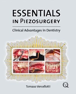 View EBOOK EPUB KINDLE PDF Essentials in Piezosurgery: Clinical Advantages in Dentistry by  Tomaso V