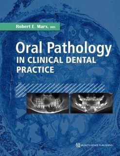 VIEW [KINDLE PDF EBOOK EPUB] Oral Pathology in Clinical Dental Practice by  Robert E. Marx 📦