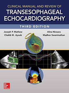 READ EPUB KINDLE PDF EBOOK Clinical Manual and Review of Transesophageal Echocardiography, 3/e by  J