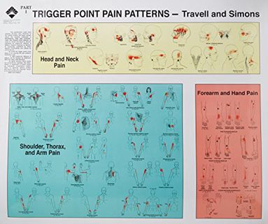 Get EPUB KINDLE PDF EBOOK Trigger Points of Pain: Wall Charts (Set of 2) by  Janet Travell MD &  Dav