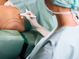 Liposuction Surgery: Dubai's Latest Technological Advancements