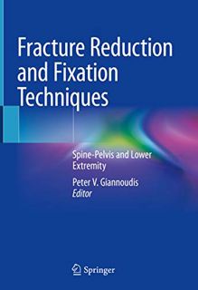 Read EBOOK EPUB KINDLE PDF Fracture Reduction and Fixation Techniques: Spine-Pelvis and Lower Extrem
