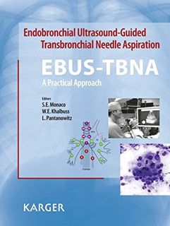 GET EPUB KINDLE PDF EBOOK Endobronchial Ultrasound-Guided Transbronchial Needle Aspiration (EBUS-TBN