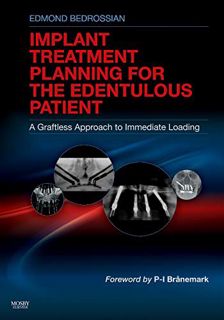 [READ] EBOOK EPUB KINDLE PDF Implant Treatment Planning for the Edentulous Patient: A Graftless Appr