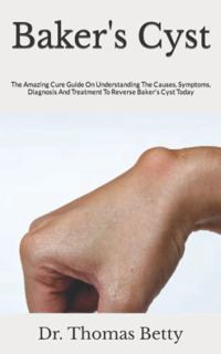 READ [PDF EBOOK EPUB KINDLE] Baker's Cyst: The Amazing Cure Guide On Understanding The Causes, Sympt