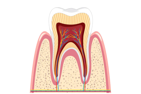 Comparing Root Canal Therapy to Alternative Treatments in Dubai