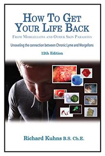 [View] [EPUB KINDLE PDF EBOOK] How to Get Your Life Back From Chronic Lyme, Morgellons and Other Ski