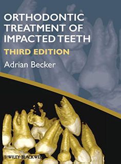 VIEW EBOOK EPUB KINDLE PDF Orthodontic Treatment of Impacted Teeth by  Adrian Becker 💛