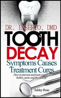 [Access] [KINDLE PDF EBOOK EPUB] Tooth Decay: Symptoms, Causes, Treatment and Cures-How to prevent a