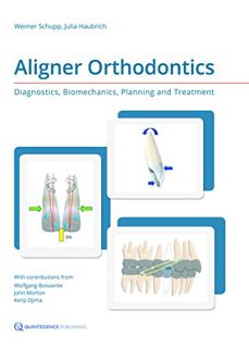 Read [PDF EBOOK EPUB KINDLE] Aligner Orthodontics: Diagnostics, Biomechanics, Planning, and Treatmen