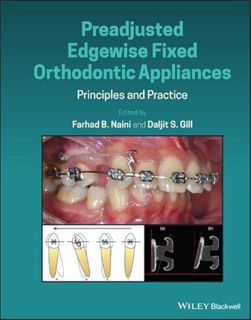 VIEW [PDF EBOOK EPUB KINDLE] Preadjusted Edgewise Fixed Orthodontic Appliances: Principles and Pract