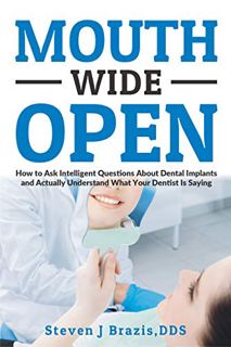 [ACCESS] [PDF EBOOK EPUB KINDLE] Mouth Wide Open: How To Ask Intelligent Questions About Dental Impl
