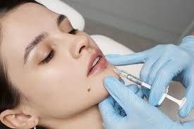 Choosing the Right Lip Filler Specialist in Dubai