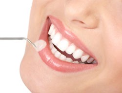 Dubai Smile Makeover on a Budget: Veneers?