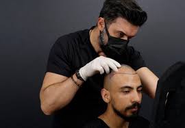 Dubai's Competitive Hair Transplant Rates