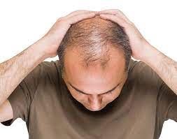 How to Administer Exosomes for Hair Growth in UAE