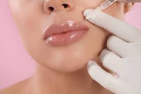 Choosing the Right Lip Filler: Options and Considerations