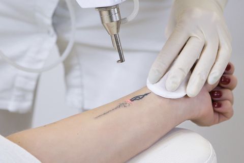 Natural Remedies for Fading Tattoos A Non-Invasive Approach in Dubai