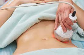 Liposuction in Dubai: Achieve Your Desired Body Contour