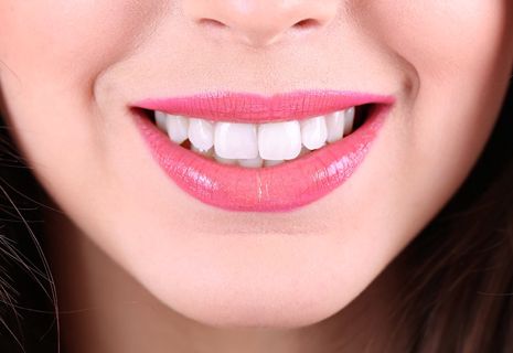 Don't Miss Out: Best Composite Veneers Deals Dubai